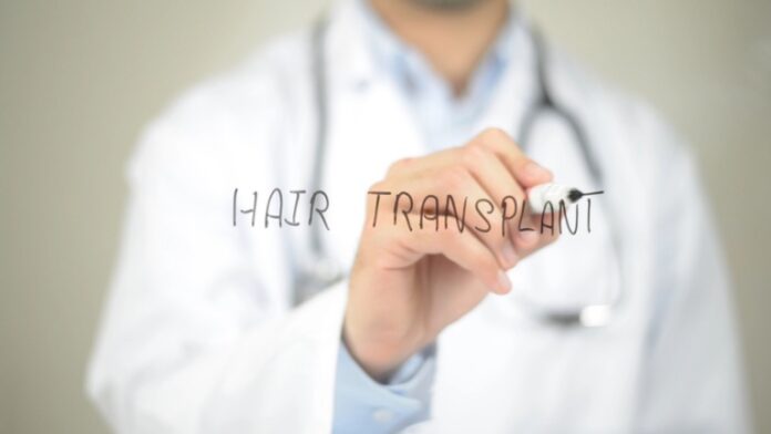 how getting a hair transplant in turkey saves you money