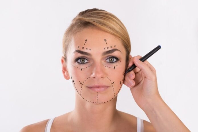 factors to consider before deciding on a facelift